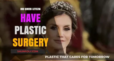 Queen Letizia's Transformation: Plastic Surgery Rumors and Speculations