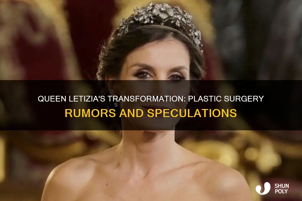 did queen letezia have plastic surgery