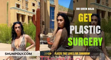 Queen Naija's Transformation: Plastic Surgery Rumors and Reality Revealed