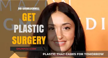 Quenblackwell's Transformation: Plastic Surgery Speculations and Facts Revealed