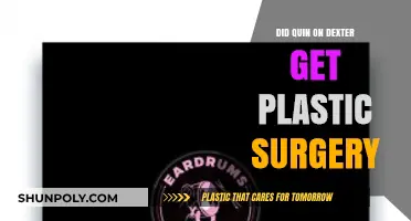 Did Quin from Dexter Undergo Plastic Surgery? Unraveling the Truth