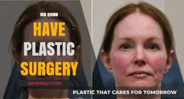 Did Quinn Undergo Plastic Surgery? Unveiling the Truth and Speculations