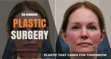 Quinn's Transformation: Plastic Surgery Speculations and the Truth Revealed