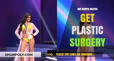 Rabiya Mateo's Transformation: Plastic Surgery Rumors Explored and Debunked