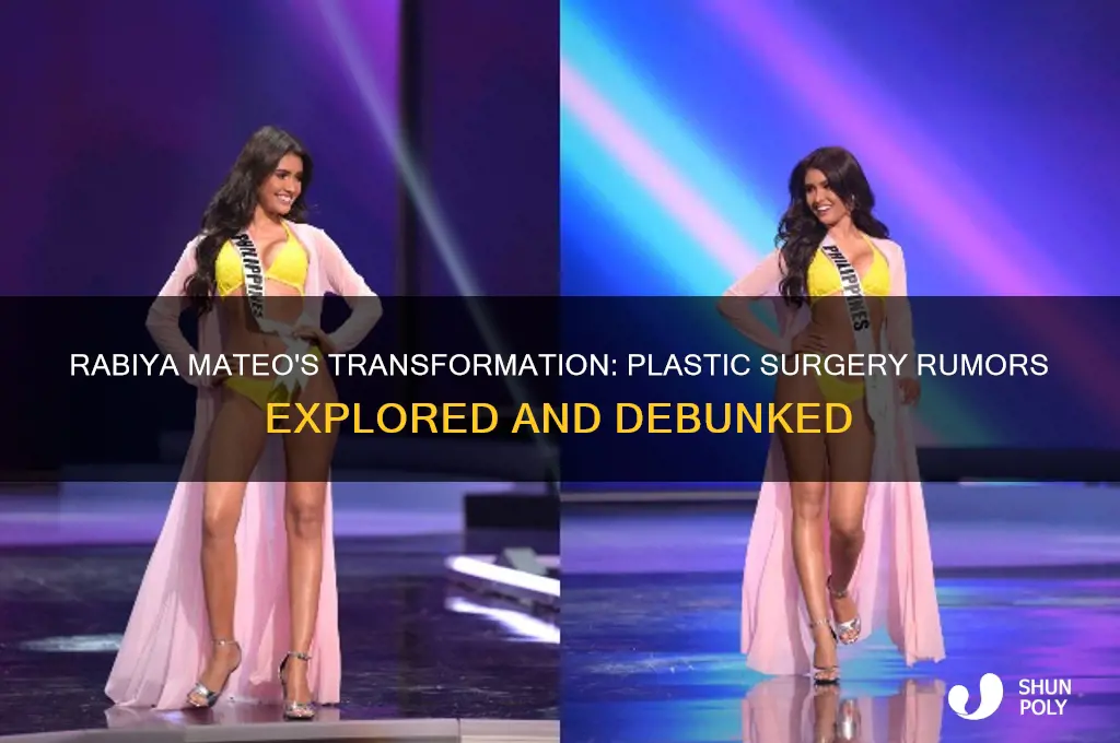 did rabiya mateo get plastic surgery