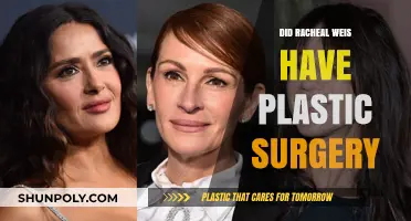 Rachel Weisz Plastic Surgery: Fact or Fiction? Unveiling the Truth