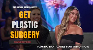 Rachel's Bachelorette Transformation: Plastic Surgery Speculations and Truths