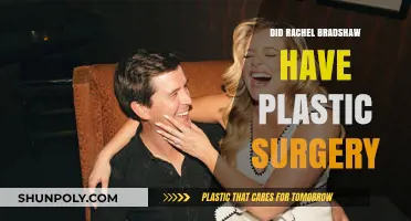 Rachel Bradshaw's Transformation: Plastic Surgery Speculations and Truths Revealed