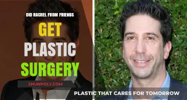 Did Rachel from Friends Undergo Plastic Surgery? Unveiling the Truth