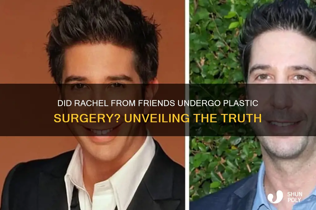did rachel from friends get plastic surgery