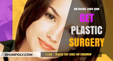 Rachel Leigh Cook Plastic Surgery: Fact or Fiction?