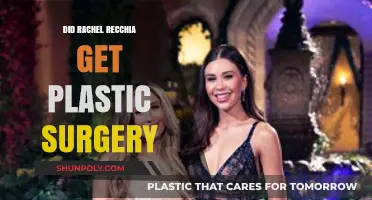 Rachel Recchia Plastic Surgery Rumors: Fact-Checking Her Transformation