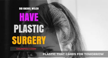Rachel Welch's Transformation: Plastic Surgery Rumors and Realities