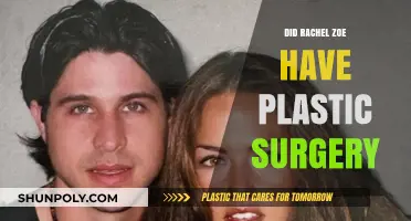 Rachel Zoe's Transformation: Plastic Surgery Speculations and Truths Revealed