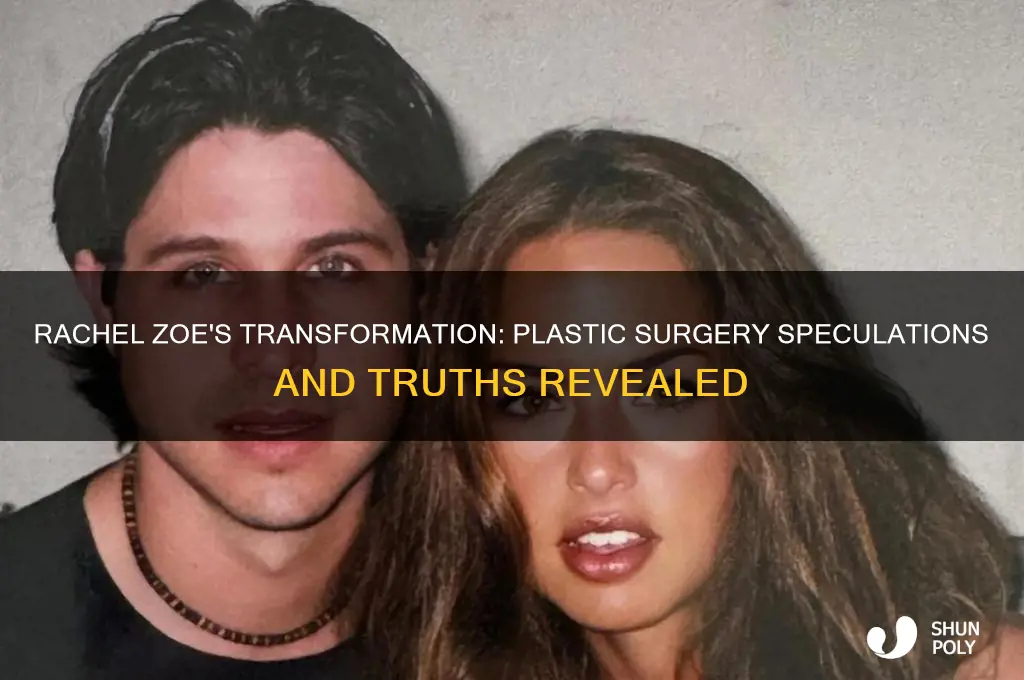 did rachel zoe have plastic surgery