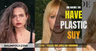 Rachel Zoe's Plastic Surgery: Did She or Didn't She?