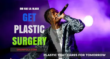 Rae Lil Black Plastic Surgery: Fact-Checking the Rumors and Speculations