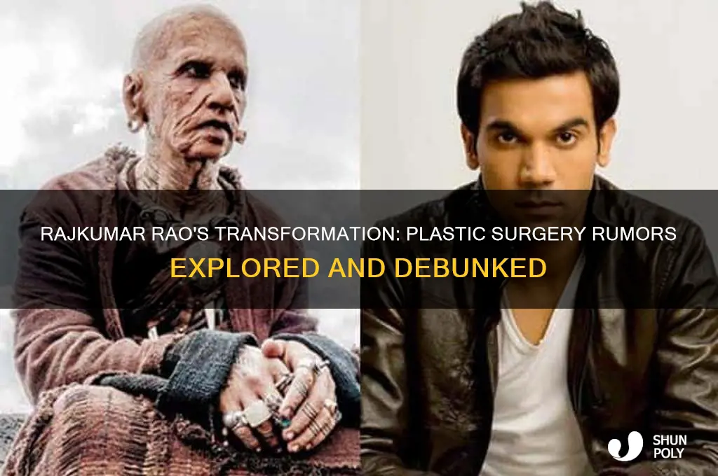 did rajkumar rao get plastic surgery