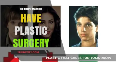 Ralph Macchio Plastic Surgery: Fact-Checking the Rumors and Speculations