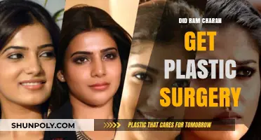 Did Ram Charan Undergo Plastic Surgery? Unveiling the Truth