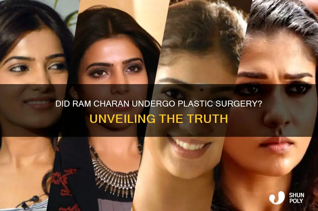 did ram charan get plastic surgery
