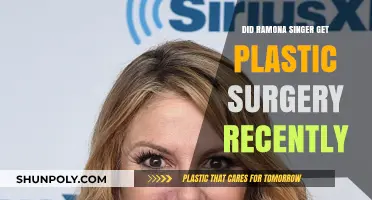 Ramona Singer's Recent Appearance Sparks Plastic Surgery Speculations