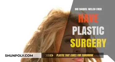 Raquel Welch's Beauty Secrets: Plastic Surgery Speculations Explored