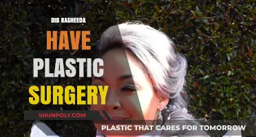 Rasheeda's Transformation: Plastic Surgery Speculations and Realities Explored