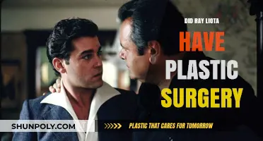 Ray Liotta's Transformation: Plastic Surgery Rumors Explored and Debunked