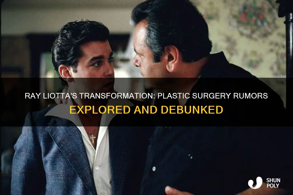 did ray liota have plastic surgery