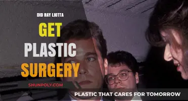 Ray Liotta's Transformation: Plastic Surgery Rumors Explored and Debunked