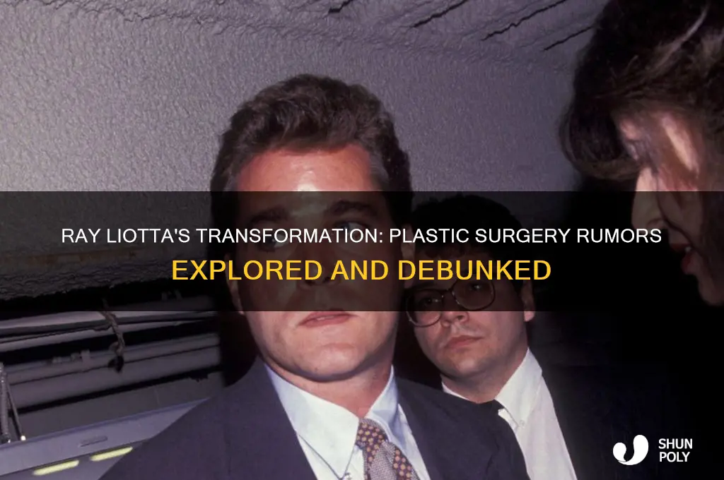 did ray liotta get plastic surgery