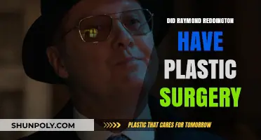Did Raymond Reddington Undergo Plastic Surgery? Unveiling the Truth