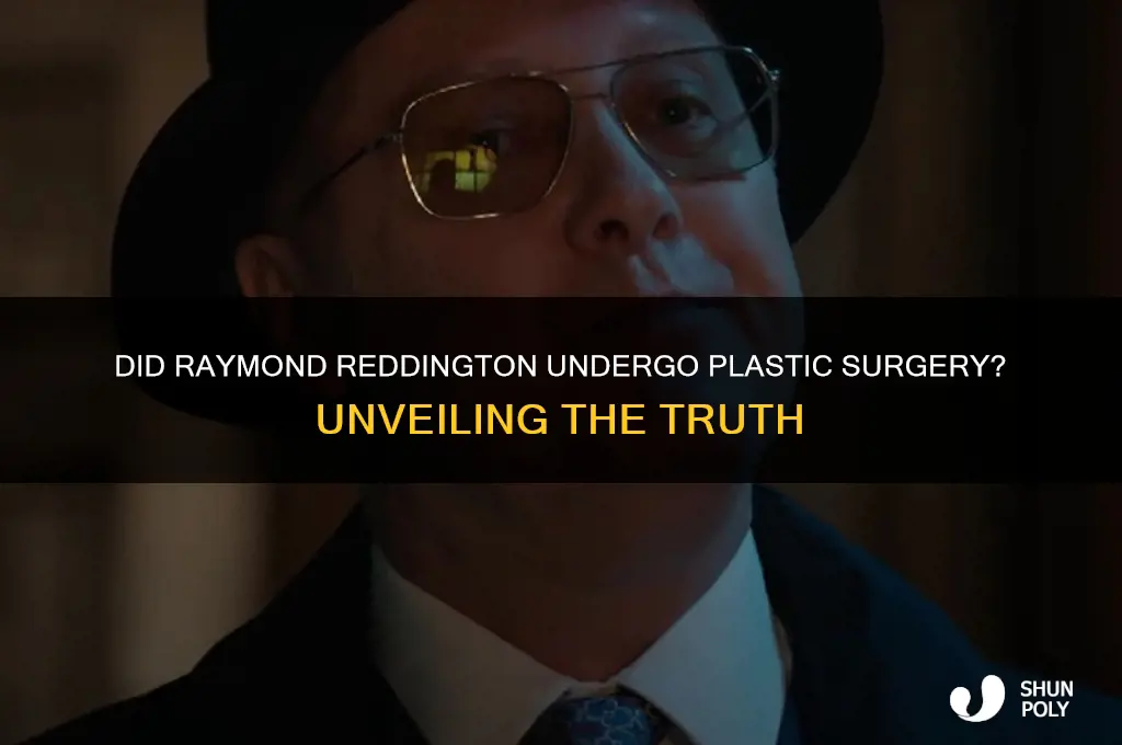 did raymond reddington have plastic surgery