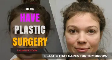 Did RBG Undergo Plastic Surgery? Unraveling the Truth Behind the Rumors