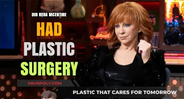Reba McEntire's Transformation: Plastic Surgery Rumors Explored