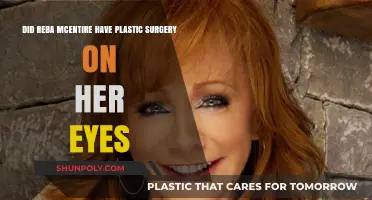 Reba McEntire's Eye Transformation: Plastic Surgery Speculations Explored