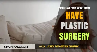 Rebecca's Transformation: Plastic Surgery Speculations on 90 Day Fiancé