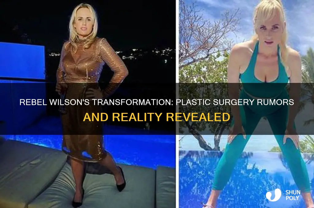did rebel wilson get plastic surgery