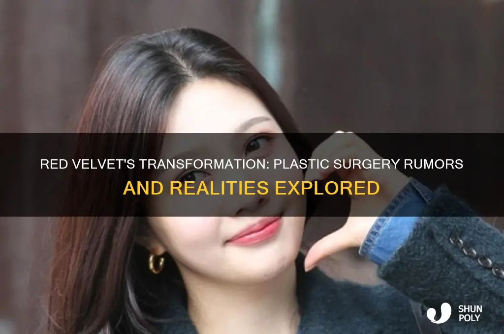 did red velvet get plastic surgery