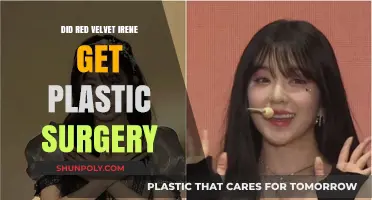 Red Velvet Irene's Transformation: Plastic Surgery Speculations Explored