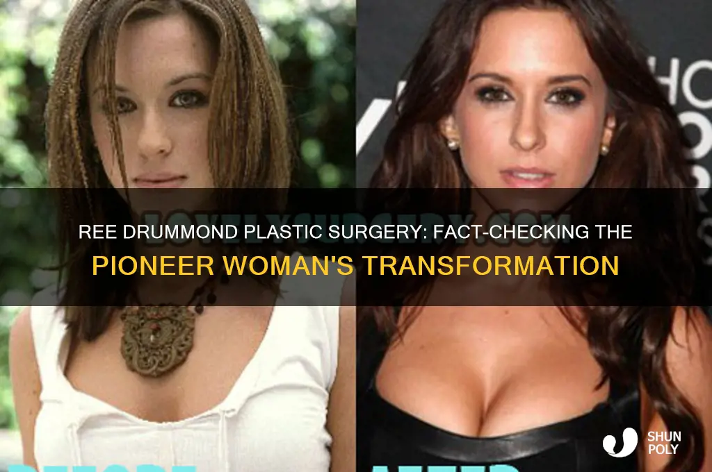did ree drummond have plastic surgery