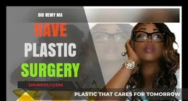 Remy Ma's Transformation: Plastic Surgery Rumors Explored and Debunked