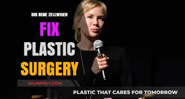 Renee Zellweger's Transformation: Plastic Surgery Rumors Explored
