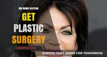 Renee Olstead Plastic Surgery: Fact-Checking the Transformation Rumors