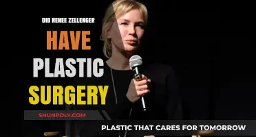 Renee Zellweger's Transformation: Plastic Surgery Speculations and Truths