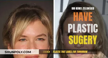 Renee Zellweger's Transformation: Plastic Surgery or Natural Evolution?