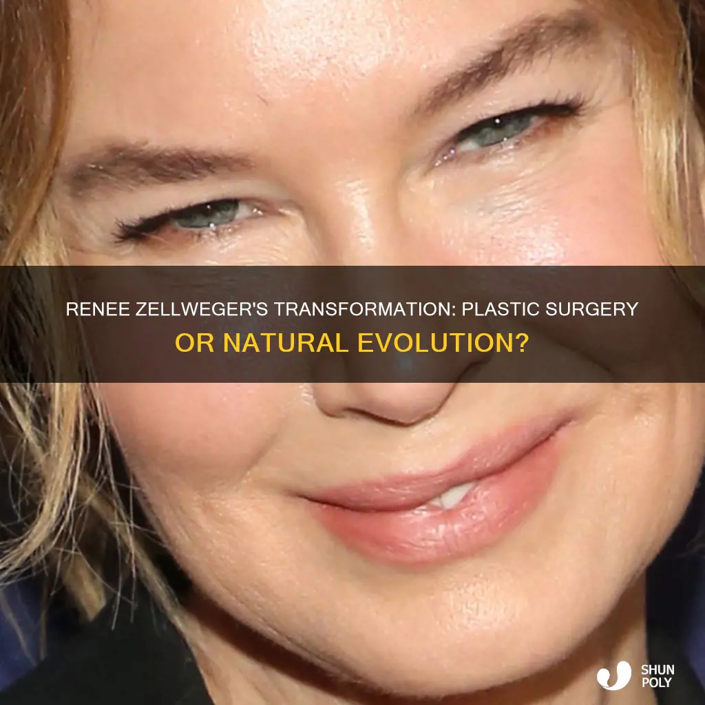 did renee zellweger have plastic sugery