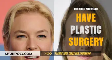 Renee Zellweger's Transformation: Plastic Surgery Rumors Explored