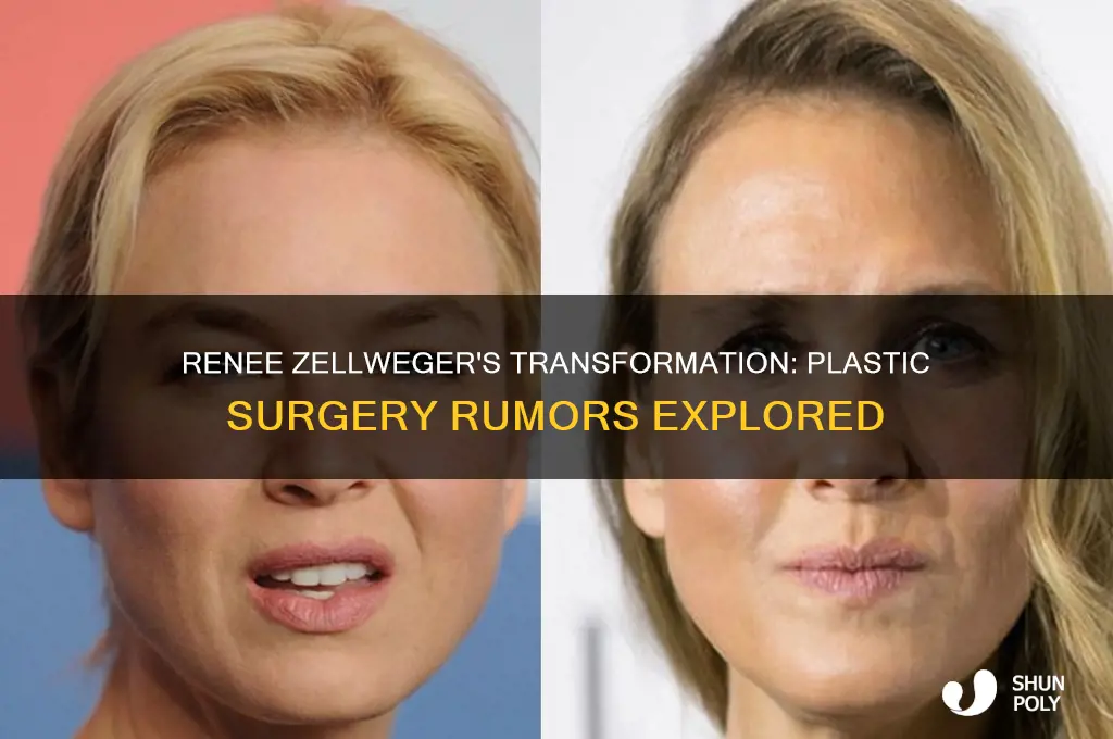 did renee zellweger have plastic surgery